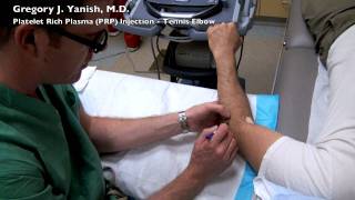 Platelet Rich Plasma PRP Injection Ultrasound Guided for Tennis Elbow [upl. by Starla690]