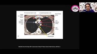 CT Thorax Radiologist perspective [upl. by Er]