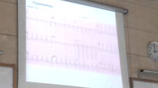 Dr Hany Gamal Hypokalemia 2  Hyperkalemia [upl. by Nevanod423]