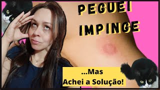 IMPINGE Pomada Milagrosa  SAROU EM 2 DIAS [upl. by Nyliac]