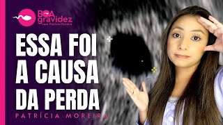 🚨SAIU O LAUDO DA PERDA Gravidez Anembrionária  Causas sintomas e como estou após a perda ❤️‍🩹 [upl. by Annahvas70]