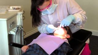 Silver Nitrate  Fluoride Varish Protocol [upl. by Hewitt]