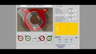 Retinoscopy Simulator Tutorial  Retinoscopy part 2 [upl. by Annert]