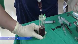 BMACPRP  Bone Marrow Aspirate ConcentratePlatelet Riched Plasma Preparation การเตรียมฺBMACPRP [upl. by Llennoj]