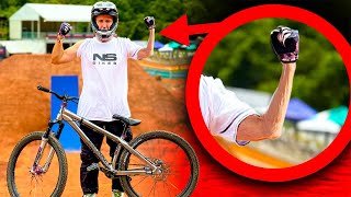 HO LESIONATO IL NERVO DEL BRACCIO  Crankworx Cairns 2024 [upl. by Odette]