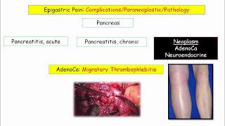 12DaysinMarch Epigastric Pain and Pancreatic Disorders for USMLE Step One [upl. by Ttezil]