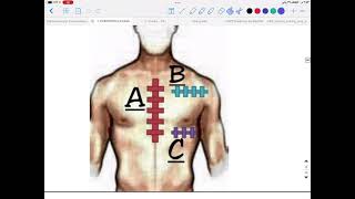 Mastering The Art of Precordial Examination  Inspection and Part of Palpation [upl. by Aprilette]