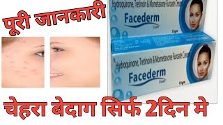 Hydroquinone Tretinoin amp Mometasone Furoate Cream Review by Guru Kirpa Clinic [upl. by Robaina]