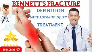 The Ultimate Guide to Bennetts Fracture Treatment Secrets [upl. by Aveneg415]