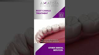 ROOT CANALS TREATMENT [upl. by Henig]