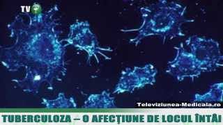 Tuberculoza  o afectiune de locul I [upl. by Ozan]