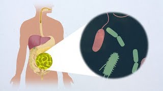 Antagonism toward the intestinal microbiota and its effect on Vibrio cholerae virulence [upl. by Pierpont]