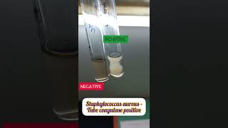 Tube coagulase test for Staphylococcus aureus staphylococcus tubecoagulase [upl. by Anailil863]