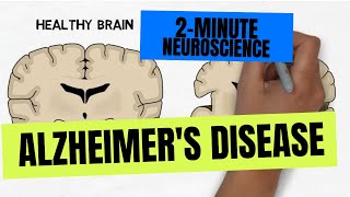 2Minute Neuroscience Alzheimers Disease [upl. by Eadwine335]