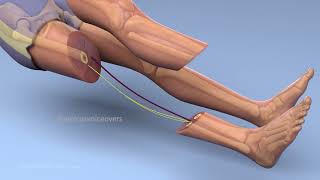 rotationplasty femur breaker [upl. by Christan]