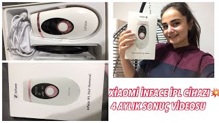 XIAOMİ INFACE IPL CİHAZI 4 AYLIK SONUÇ VİDEOSU 🎉 [upl. by Assyli]