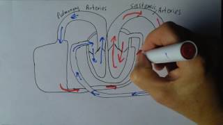 Cardiovascular System Disorders Parts 1  5 [upl. by Alesiram340]