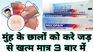 MUCOPAIN GEL REVIEW IN HINDI  HOW TO USE OF MUCOPAIN GEL CREAM [upl. by Humphrey]