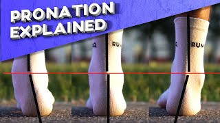 What is overpronation  Pronation types explained [upl. by Bornstein]