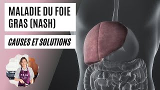 NASH  stéatose hépatique foie gras  causes et solutions [upl. by Yelssew]