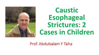 Caustic Esophageal Strictures Two Cases in Children [upl. by Etnod]