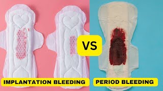 lmplantation bleeding vs periodimplantation bleedingimplantation bleeding or period [upl. by Errick750]