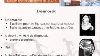 Ligamentoplastie cheville clinique du sport Dr CORDIER [upl. by Eneroc]