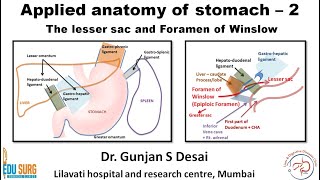 Lesser sac and foramen of Winslow  Applied anatomy of stomach part 2 [upl. by Amil]