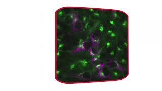 How to combine fluorescence and brightfield imaging [upl. by Nyvets81]