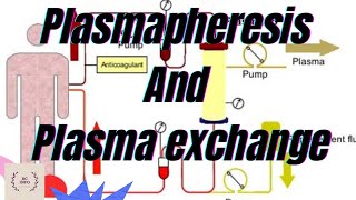 Plasmapheresis part1Plasma exchangeTherapeutic plasma exchangetherapeutic plasmapheresisTPEPE [upl. by Napas167]