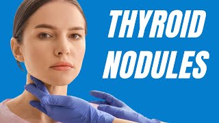 Understanding Thyroid Nodules Causes Symptoms amp Treatment Options [upl. by Kepner552]