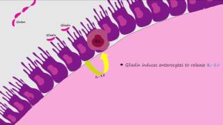 Celiac Disease Pathogenesis Described Concisely and in Detail [upl. by Miett]