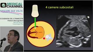 Ecografia del Cuore fetale [upl. by Imoyn246]