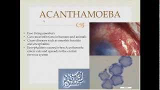 Parasitology Acanthamoeba [upl. by Kjersti]