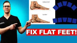 How To FIX Flat Feet 16 BEST Home Remedies Shoes amp Arch Insoles [upl. by Azriel]