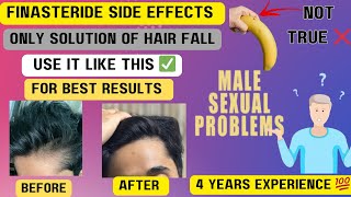 FINASTERIDE Side Effects RESULTS after 2 years use  Only SOLUTION of hairfall [upl. by Ahtivak]