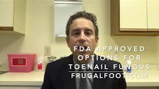 FDA Approved Options For Toenail Fungus [upl. by Ary]