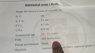 baby boy scanning Reports12weeks baby boy scanning162bpm baby boy or girl baby boy scan reports [upl. by Wolfgang]