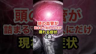 頭の血管が詰まる寸前の人にだけ現れる症状【5選】 長寿命 [upl. by Ahsyad89]