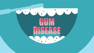 Wave goodbye to gum disease with Listerine® [upl. by Negiam738]