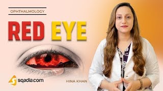 Red Eye  Episcleritis  Ophthalmology Video Lectures  Medical Education  VLearning [upl. by Arihaz]