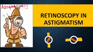 RETINOSCOPY in ASTIGMATISM  Break intensity  brightness and skew  Straddling [upl. by Noemad]