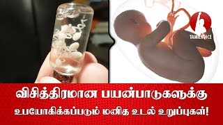 தீக்காயம் ஏற்பட்டால் உடனடியாக இதை செய்திடுங்கள் What to do immediately for burn wounds  Tamil TV [upl. by Atterrol79]