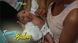 Tunay na Buhay Sanggol na may Anencephaly patuloy na lumalaban sa kabila ng kondisyon [upl. by Hughett966]