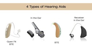 Types of Hearing Aids [upl. by Fira184]