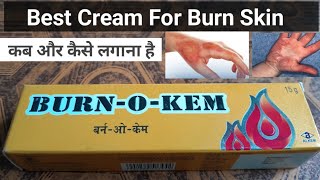 Burn O Kem Cream Antiseptic cream [upl. by Annavoj]