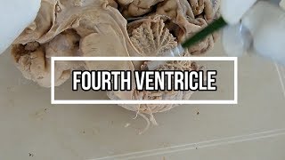 Fourth ventricle  neuroanatomy  floor  opening [upl. by Olracnaig328]