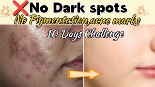 10 Days challenge remove Dark spots pigmentation acne marks uneven skin tone100 results [upl. by Daegal996]