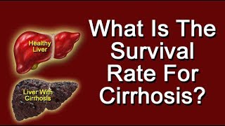 What Is The Survival Rate For Cirrhosis Of The Liver [upl. by Immot]