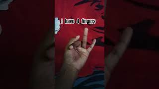 I have 4 fingers  VivekGuptaReactions youtubeshorts trending like share subscribe trend [upl. by Einotna795]